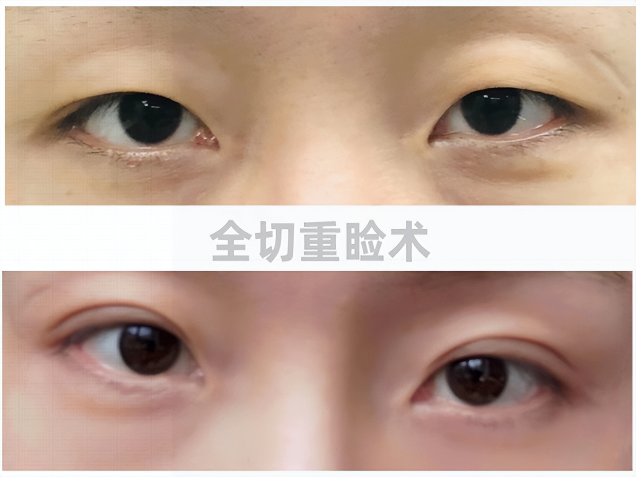暑期变美正当时！河北省人民医院医疗美容科专家团队助你焕新颜